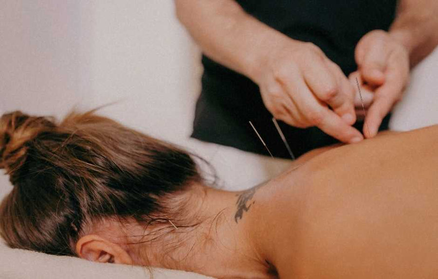Acupuncture for Fertility: How It Can Support Ovulation, Implantation, and Reproductive Health